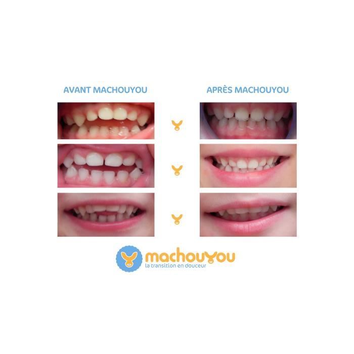 Machouyou First Teeth Device - Plum - For 2 Years and Up
