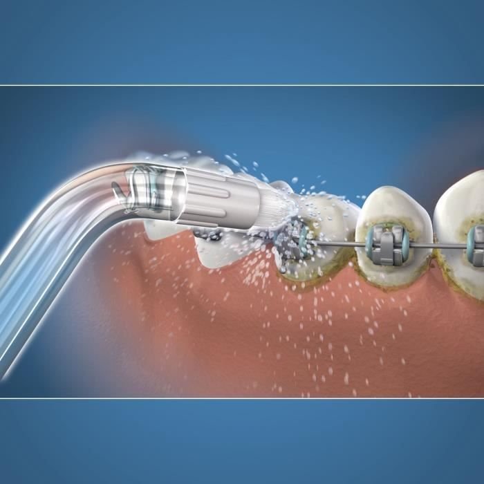 Water Flosser Tip - WATERPIK - Orthodontic - Removes plaque - Specially designed for dental appliances