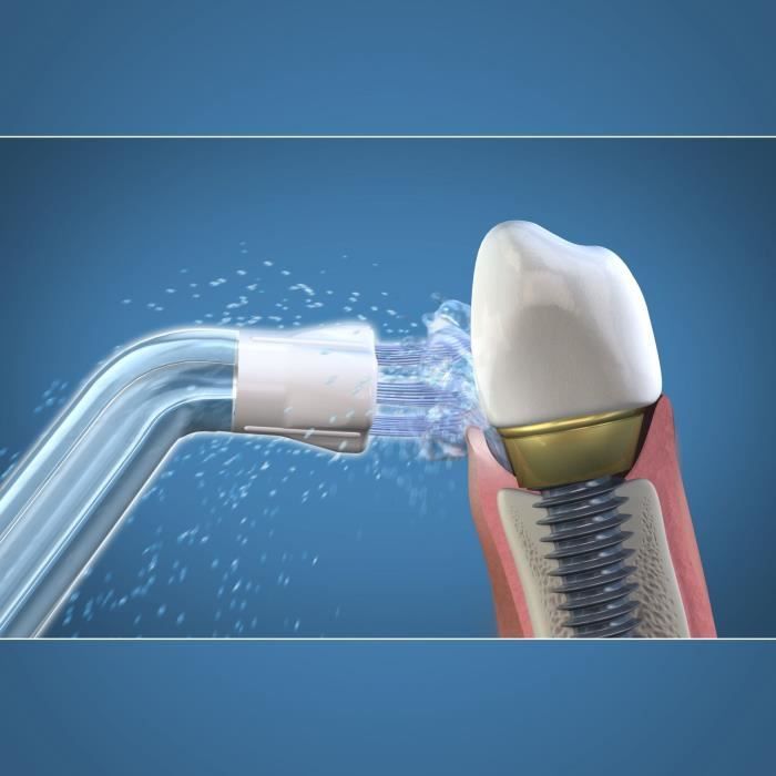 Water Flosser Nozzle - WATERPIK - Plaque Seeker - Removes plaque
