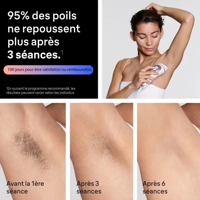 BRAUN IPL Hair Removal System - Semi-permanent - Pulsed Light - Laser - Electrolysis